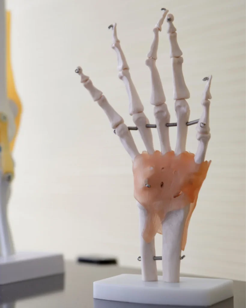 Tendon Related Wrist Pain